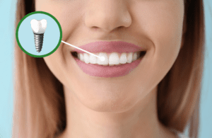 Dental Implants Smiles for Life Family Dentistry dentist in las vegas nevada Dr. John M. Quinn, Dr. Joseph Wills, or Dr. Paul Leatham